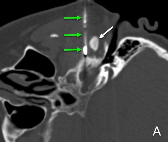stellenangebote neuroradiologie